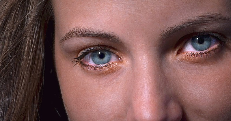 6 Things That Can Change Your Eye Color